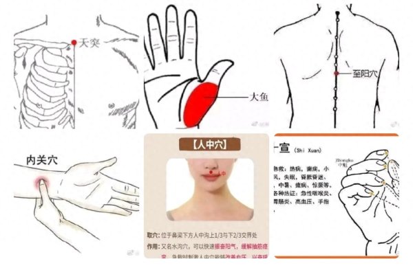 别再误解中医! 关键时刻能救命! 这5大中医急救法, 快存下
